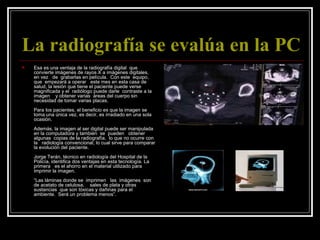 La radiografía se evalúa en la PC   Esa es una ventaja de la radiografía digital  que convierte imágenes de rayos X a imágenes digitales,   en vez   de  grabarlas en película.  Con este  equipo, que  empezará a operar   este mes en esta casa de salud, la lesión que tiene el paciente puede verse magnificada y el  radiólogo puede darle  contraste a la imagen    y obtener varias  áreas del cuerpo sin necesidad de tomar varias placas.  Para los pacientes, el beneficio es que la imagen se toma una única vez, es decir, es irradiado en una sola ocasión.   Además, la imagen al ser digital puede ser manipulada en la computadora y también  se  pueden   obtener algunas  copias de la radiografía,  lo que no ocurre con la   radiología convencional, lo cual sirve para comparar la evolución del paciente. Jorge Terán, técnico en radiología del Hospital de la Policía, identifica dos ventajas en esta tecnología. La primera   es el ahorro en el material utilizado para imprimir la imagen.   “Las láminas donde se  imprimen   las  imágenes  son de acetato de celulosa,    sales de plata y otras sustancias  que son tóxicas y dañinas para el ambiente.  Será un problema menos”. 