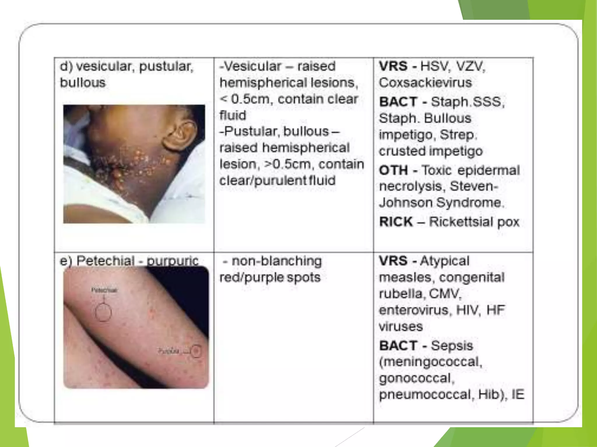 approach to child with fever and Rash | PPTX