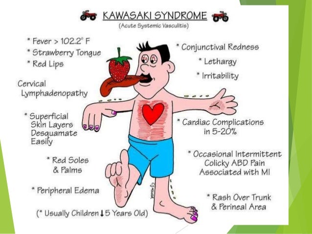 Approach To Child With Fever And Rash