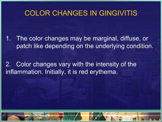 Gingivits | PPTX