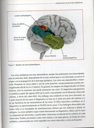 Marzia elsa   crisis-epilepticas