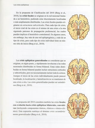 Marzia elsa   crisis-epilepticas