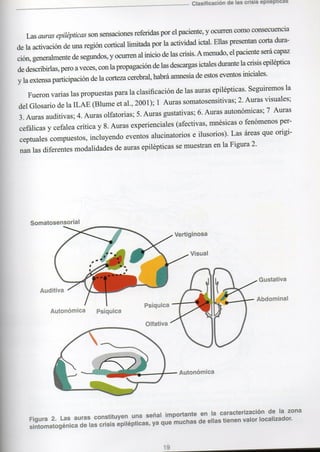 Marzia elsa   crisis-epilepticas