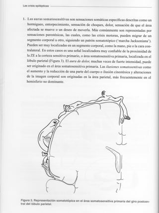 Marzia elsa   crisis-epilepticas