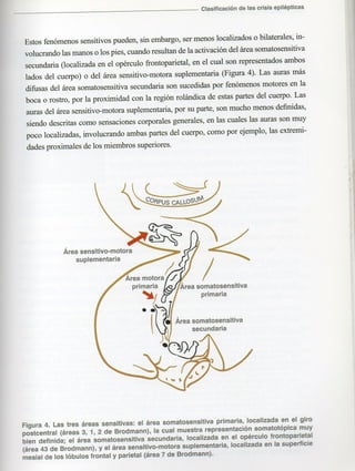Marzia elsa   crisis-epilepticas