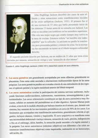 Marzia elsa   crisis-epilepticas