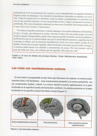 Marzia elsa   crisis-epilepticas