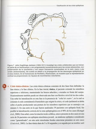 Marzia elsa   crisis-epilepticas