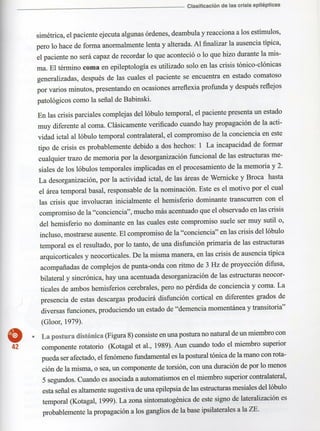 Marzia elsa   crisis-epilepticas