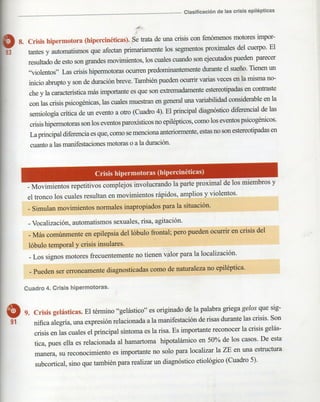 Marzia elsa   crisis-epilepticas