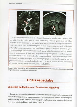 Marzia elsa   crisis-epilepticas