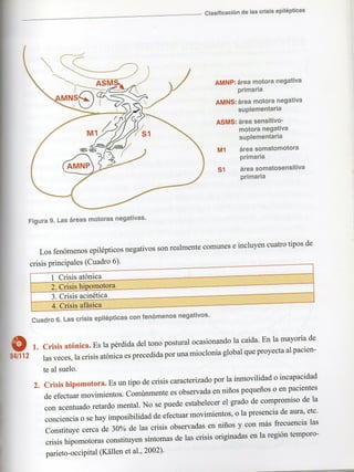 Marzia elsa   crisis-epilepticas