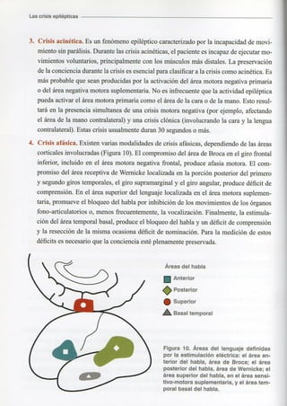 Marzia elsa   crisis-epilepticas