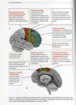 Marzia elsa   crisis-epilepticas