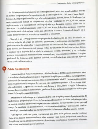 Marzia elsa   crisis-epilepticas