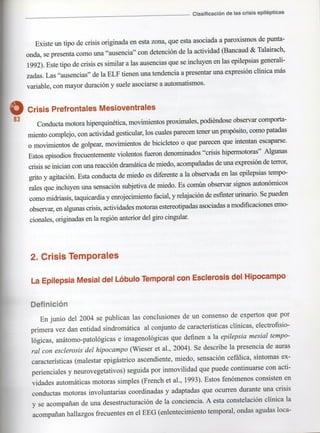 Marzia elsa   crisis-epilepticas