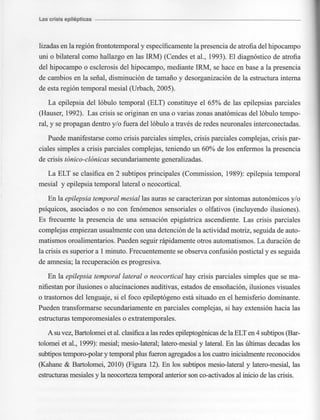 Marzia elsa   crisis-epilepticas
