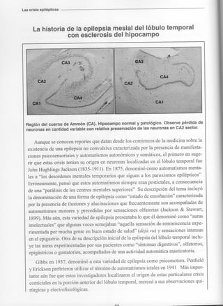 Marzia elsa   crisis-epilepticas