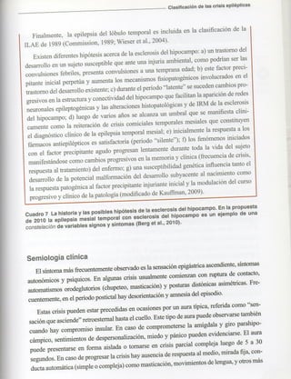 Marzia elsa   crisis-epilepticas