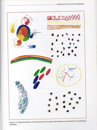 Marzia elsa   crisis-epilepticas