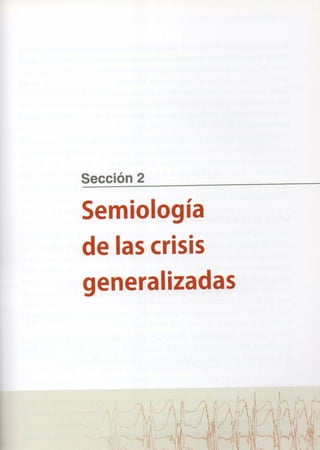 Marzia elsa   crisis-epilepticas