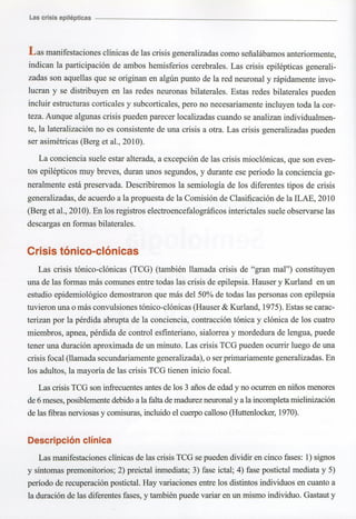 Marzia elsa   crisis-epilepticas