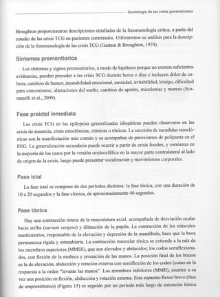 Marzia elsa   crisis-epilepticas