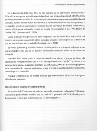 Marzia elsa   crisis-epilepticas
