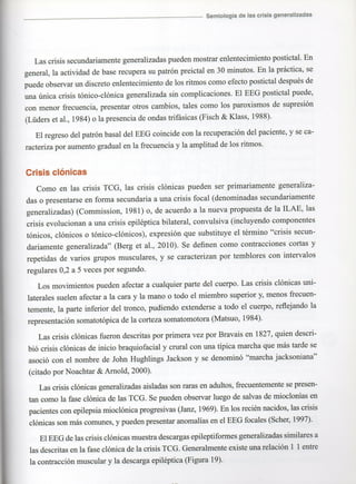 Marzia elsa   crisis-epilepticas