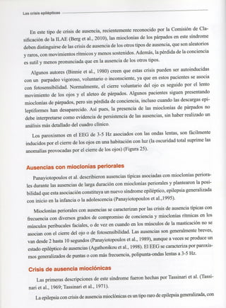 Marzia elsa   crisis-epilepticas