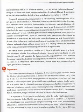 Marzia elsa   crisis-epilepticas