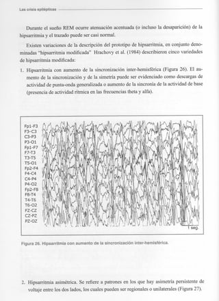 Marzia elsa   crisis-epilepticas