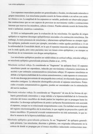 Marzia elsa   crisis-epilepticas