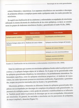 Marzia elsa   crisis-epilepticas