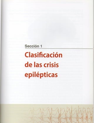 Marzia elsa   crisis-epilepticas