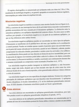 Marzia elsa   crisis-epilepticas