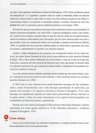 Marzia elsa   crisis-epilepticas