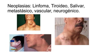 Neoplasias: Linfoma, Tiroideo, Salivar,
metastásico, vascular, neurogénico.
 