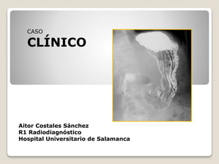 Aitor Costales Sánchez
R1 Radiodiagnóstico
Hospital Universitario de Salamanca
CASO
CLÍNICO
 