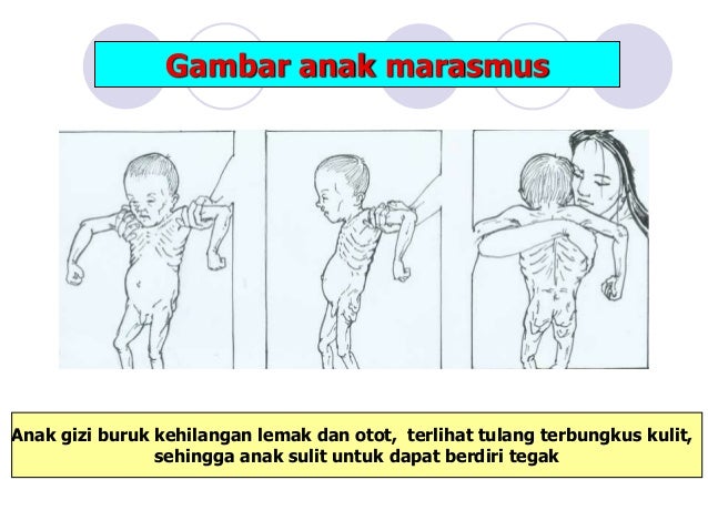 Masalah Gz Dh
