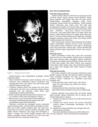 Cermin Dania Kedokteran No. 34, 1984 29 
Gambar 1 : Angiogram karotis normal. 
Keadaan-keadaan yang mengakibatkan peninggian tekanan 
intrakranial adalah : 
1. Massa intrakranial yang besar seperti neoplasma, abses atau 
hematoma akan menimbulkan tekanan intrakranial yang 
meninggi.Otak lebih sering tertekan dari pada tulang kepala 
apabila tumbuhnya dengan cepat. 
2. Terjadinya obstruksi parsial atau komplit dari aliran likuor 
serebrospinal, baik oleh massa intrakranial ataupun kelainan 
kongenital, atau oleh perlekatan setelah infeksi dapat 
mengakibatkan terjadinya hidrosefalus. 
3. Edema serebral yang terjadi sebagai akibat neoplasma, ab-ses, 
ensefalitis, infark serebri atau hipertensi vaskuler. 
4. Kronio stenosis, yaitu suatu keadaan dimana tengkorak te-lah 
berhenti berkembang pada saat jaringan otak masih 
membutuhkan tempat untuk berkembang. 
Manifestasi radiologik dari peninggian tekanan intrakranial 
sangat bergantung pada : periode timbulnya peninggian tersebut 
(akut atau kronik), apakah terjadinya pada saat masih bayi, 
kanak-kanak atau dewasa. Biasanya kelainan radiologik timbul 
apabila tekanan intrakranial yang tinggi telah berlangsung 5 
sampai 6 minggu. Dua daerah menjadi pegangan akan ada 
tidaknya peninggian tekanan intrakranial ini, yaitu sutura pada 
kanak-kanak dan sela tursika pada orang dewasa. 
KELAINAN RADIOLOGIK 
Efek pada tulang tengkorak 
Apabila kenaikan tekanan intrakranial ini terjadi pada periode 
ante-natal sampai minggu pertama setelah kelahiran, tulang-tulang 
tengkorak akan tampak lebih tipis dari pada normal, 
kadang-kadang menunjukkan kegagalan dalam proses 
penulangan (sebuah bentuk dari kraniolakuna). Tetapi kenaikan 
tekanan intrakranial yang terjadi secara akut tidak akan 
mempengaruhi penebalan atau bentuk tulang tengkorak. Tanda 
lain dari kenaikan tekanan intrakranial pada kanak-kanak adalah 
yang dinamakan impressiones digitatae (Convolutional 
impressions) yang terjadi pada bagian atas tulang frontal dan 
parietal. Tetapi apabila gambaran ini tampak pada tulang teng-korak 
2/3 bawah ia tidak mempunyai nilai diagnostik, melainkan 
dianggap merupakan respons dari tulang yang sedang tumbuh 
terhadap jaringan otak di bawahnya. 
Pada orang dewasa, kelainan yang berlangsung lama kadang-kadang 
menimbulkan penipisan kalvaria secara menyeluruh. 
Tetapi apabila tekanan intrakranial yang tinggi ini berlangsung 
sejak masa kanak-kanak, misalnya pada_ stenosis akuaduk akan 
terjadi pelebaran bagian supratentorial, kecuali fossa posterior 
serebri. 
Efek pada sutura 
Dalam pertumbuhan seorang anak, sutura akan menyempit 
pada rata rata usia 1 tahun pertama. Apabila sutura ini tetap lebar 
maka patut dicurigai adanya peninggian tekanan intrakranial. 
Yang paling jelas adalah sutura lambdoidea. Diastasis dari sutura 
ini lebih nyata apabila telah terjadi osifikasi yang sempurna. 
Untuk dapat melihat dengan nyata, maka diperlukan pengaturan 
posisi kepala anak sehingga tidak terjadi superposisi dengan 
jaringan lain. 
Efek pada sela tursika 
Sela tursika merupakan salah satu bagian intrakranial yang di 
gunakan sebagai tolok-ukur ada tidaknya kenaikan intrakranial. 
Untuk mendeteksi perubahan dini pada sela tursika akibat 
kenaikan tekanan intrakranial ini, diperlukan syarat-syarat 
radiologik yaitu : 
— Posisi pemotretan harus lateral murni, arah sinar-X 
tegak lurus pada bidang yang melalui sela tursika. 
(bidang sagital). 
— Teknik pemotretan harus sedemikian rupa sehingga 
dapat dilihat adanya perubahan yang men-detail pada tulang. 
Kelainan radiologik yang tampak pada sela tursika sebagai 
akibat kenaikan tekanan intrakranial, oleh du Boulay dan El 
Gammal dibagi dalam 3 kategori : 
I. Tampak erosi pada garis korteks sela tursika dekat basis dari 
dorsum sela. 
II. Destruksi dari puncak dorsum sela prosesus (klinoideus 
anterior) dengan kecendrungan terdorongnya sisa dari 
lamina dura. 
III. Apabila erosi tulang sedemikian rupa sehingga telah meli-batkan 
planum sfenoidale. 
Harus dapat dibedakan kelainan yang timbul akibat tumor 
intra atau suprasellar. Tumor intrasellar akan mengakibatkan 
 