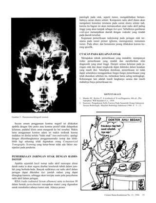 Cermin Dunia Kedokteran No. 31, 1984 35 
Gambar 3 : Pneumoensefalografi normal. 
Secara umum penggunaan kontras negatif ini dilakukan 
apabila dengan foto polos atau kontras positif tidak didapatkan 
kelainan, padahal klinis amat mengarah ke hal tersebut. Makin 
lama penggunaan kontras udara ini makin terdesak karena 
tindakan ini dinilai terlalu "tidak enak" (uncomfortable), apalagi 
dengan dikembangkannya penggunaanradio isotop dan lebih-lebih 
lagi sekarang telah digunakan orang Computerized 
Tomography Scanning yang benar-benar tidak ada faktor ma-nipulasi 
pada penderita. 
PEMERIKSAAN JARINGAN OTAK DENGAN RADIO-ISOTOP 
Apabila sejumlah kecil isotop radio aktif mencapai aliran 
darah maka ia akan segera disebar keseluruh tubuh dalam jum-lah 
yang berbeda-beda. Banyak sedikitnya zat radio aktif dalam 
jaringan dapat diketahui dari jumlah radiasi yang dapat 
ditangkap kamera, sehingga akan tercipta suatu pola penyebaran 
radio aktif dalam jaringan. 
RISA (radio iodinated Serum albumen) serta technetium 99 
dalam bentuk pertechnetate merupakan materi yang digunakan 
untuk mendeteksi adanya tumor otak. Adanya proses 
patologik pada otak, seperti tumor, mengakibatkan bertam-bahnya 
cairan ekstra seluler. Komponen radio aktif diatas akan 
mengalami kumulasi terutama pada cairan ekstra seluler tadi, 
karena itu bagian ini akan memancarkan sinar radio aktif paling 
tinggi yang akan tampak sebagai hot-spot. Sebaliknya gambaran 
cold-spot menunjukkan daerah dengan vaskuler yang rendah 
pada daerah tersebut. 
Kegunaan pemeriksaan radioisotop pada jaringan otak ter-utama 
pada tumor primer (glioma, meningioma), metastasis 
tumor. Pada abses. dan hematoma jarang dilakukan karena ku-rang 
spesifik. 
CT SCAN PADA KELAINAN OTAK 
Merupakan teknik pemeriksaan yang mutakhir, mempunyai 
risiko pemeriksaan yang rendah dan memberikan nilai 
diagnostik yang amat tinggi. Hampir semua kelainan pada ja-ringan 
otak dan dasar tengkorak dapat dideteksi dalam keadaan 
yang masih dini. Sekalipun demikian, pemeriksaan ini tidak 
dapat seluruhnya menggantikan fungsi-fungsi pemeriksaan yang 
telah diuraikan sebelum ini, melainkan harus saling melengkapi. 
Kekurangan lain adalah masih langkanya sarana dan masih 
mahalnya biaya pemeriksaan ini. 
KEPUSTAKAAN 
1. Shanks SC, Kerley P. A textbook of X-rayDiagnosis. 4th ed., Phi-ladelphia: 
WB Saunders Co., 1959. 
2. Susworo. Pengukuran Sella Tursica Pada Sejumlah Orang Indonesia 
Secara Radiologik. Majalah Radiologi Indonesia 1980; 4 : 5 - 13. 
 