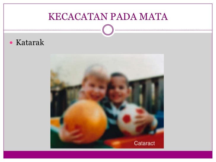 Masalah penglihatan Masalah penglihatan