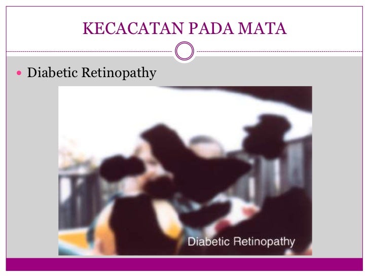 Masalah penglihatan