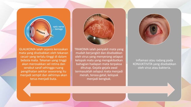 Masalah penglihatan | PPTX