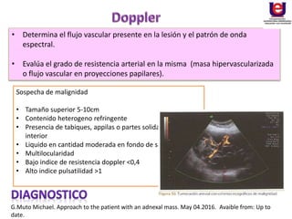 Sospecha de malignidad
• Tamaño superior 5-10cm
• Contenido heterogeno refringente
• Presencia de tabiques, appilas o partes solidas en el
interior
• Liquido en cantidad moderada en fondo de saco o ascitis
• Multilocularidad
• Bajo indice de resistencia doppler <0,4
• Alto indice pulsatilidad >1
G.Muto Michael. Approach to the patient with an adnexal mass. May 04.2016. Avaible from: Up to
date.
• Determina el flujo vascular presente en la lesión y el patrón de onda
espectral.
• Evalúa el grado de resistencia arterial en la misma (masa hipervascularizada
o flujo vascular en proyecciones papilares).
 