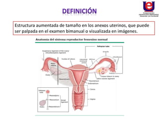 Estructura aumentada de tamaño en los anexos uterinos, que puede
ser palpada en el examen bimanual o visualizada en imágenes.
 