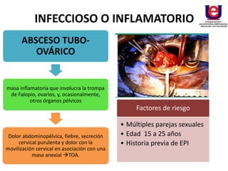INFECCIOSO O INFLAMATORIO
ABSCESO TUBO-
OVÁRICO
masa inflamatoria que involucra la trompa
de Falopio, ovarios, y, ocasionalmente,
otros órganos pélvicos
Dolor abdominopélvica, fiebre, secreción
cervical purulenta y dolor con la
movilización cervical en asociación con una
masa anexial TOA.
Factores de riesgo
• Múltiples parejas sexuales
• Edad 15 a 25 años
• Historia previa de EPI
 