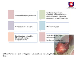 Tumores de células germinales
Teratoma-disgerminoma –
tumor del seno endodermico-
coriocarcinoma – carcinoma
embrionario – gonodoblastoma
Tumoración mas frecuente Mayoria benignos
Constituido por tejido bien
diferenciado maligno
excepcionalmente
Tejido de las tres capas
embrionarias
Predominio ectodremico
G.Muto Michael. Approach to the patient with an adnexal mass. May 04.2016. Avaible from: Up to
date.
 