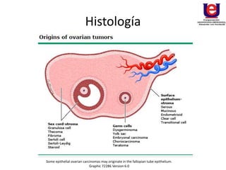 Histología
Some epithelial ovarian carcinomas may originate in the fallopian tube epithelium.
Graphic 72286 Version 6.0
 
